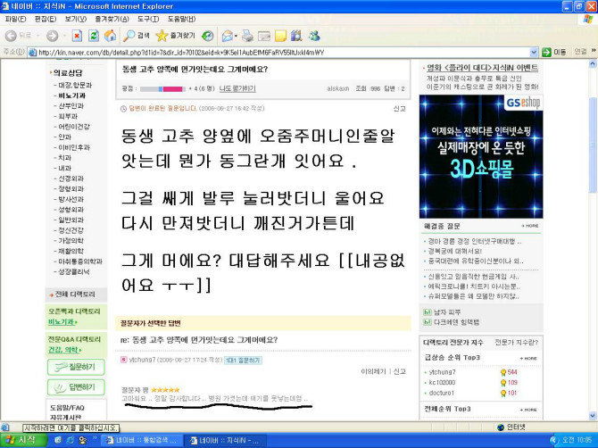 동생 고추 양옆