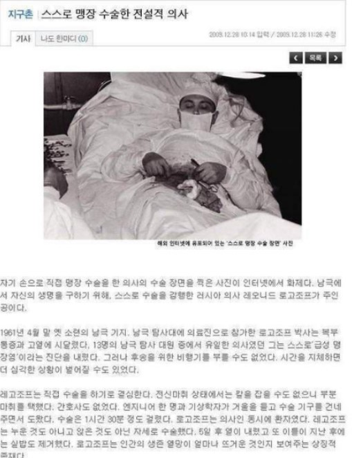 스스로 맹장수술을...대단!! 