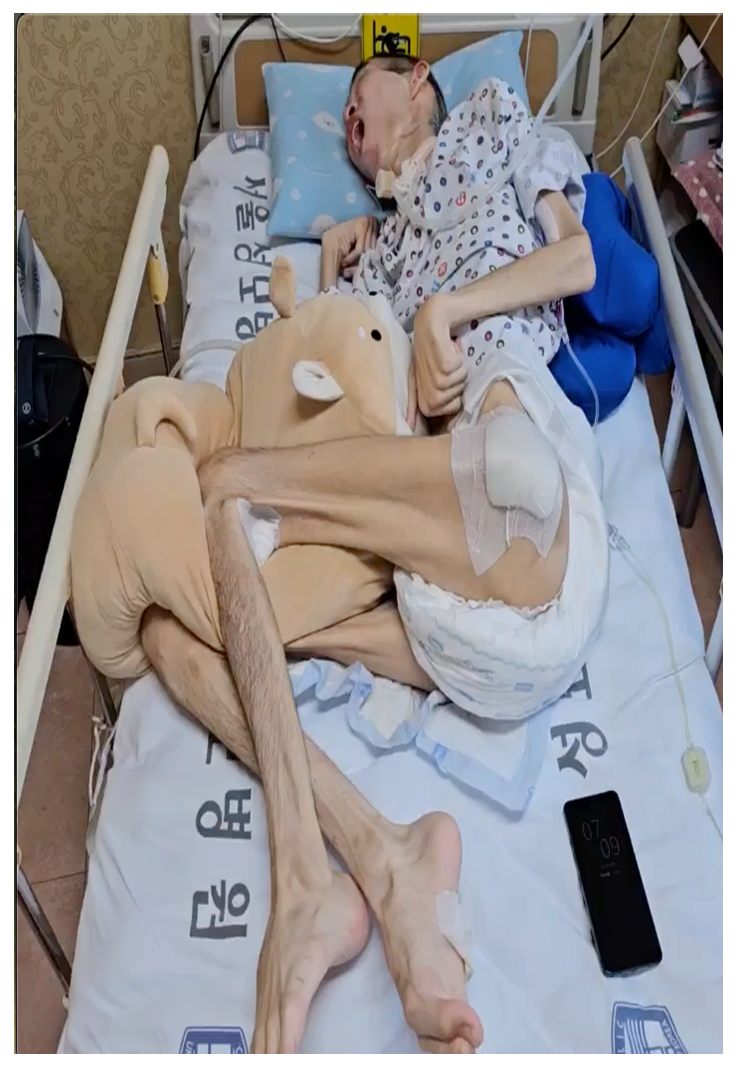 최근 현식상태.png