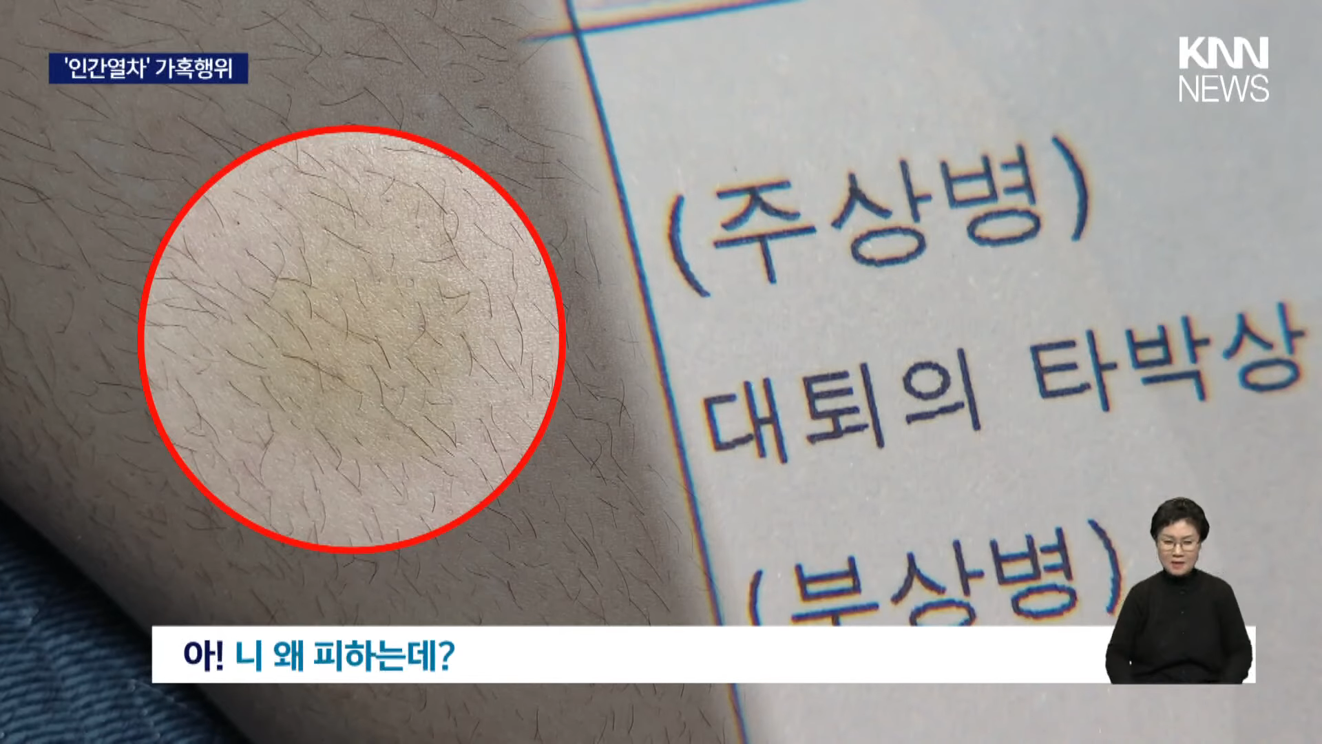 [단독] 교실에서 '인간열차' 가혹행위, 검찰 기소 _ KNN 1-16 screenshot.png