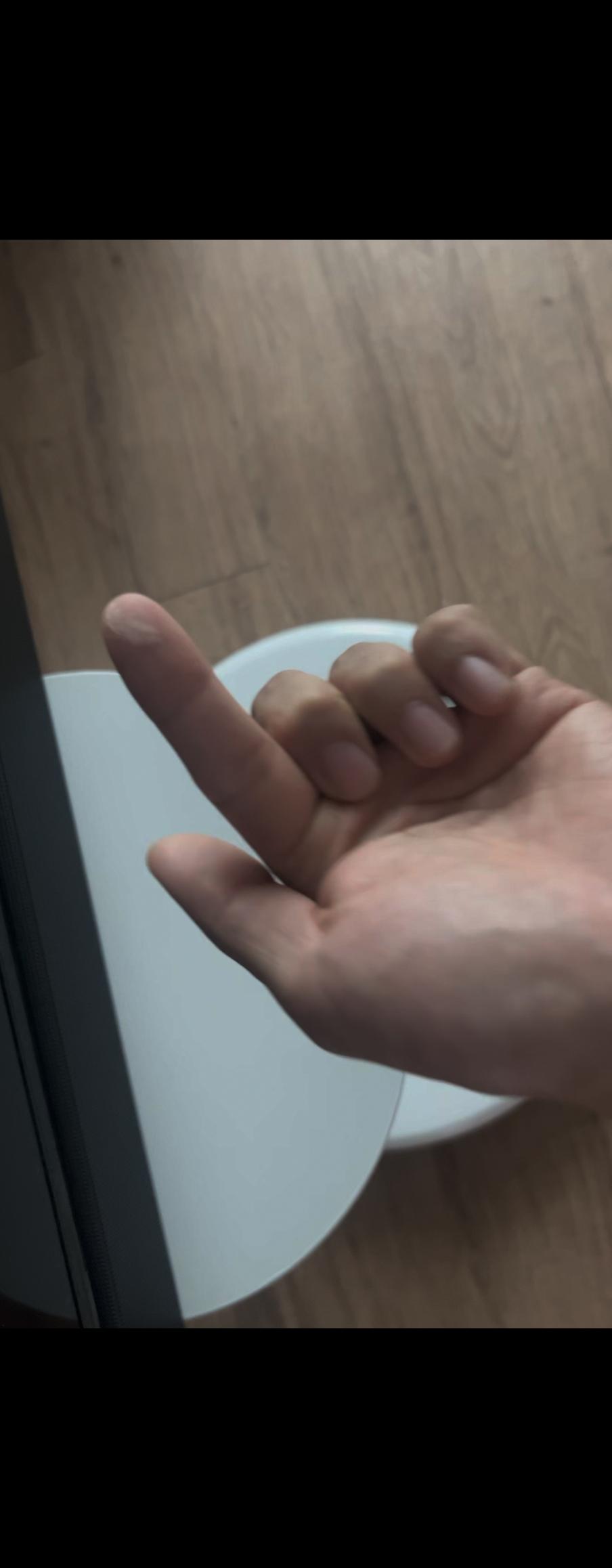 1000036377.jpg