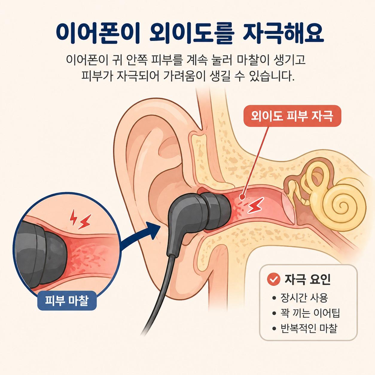이어폰 외이도염 이비인후과 귀.jpg