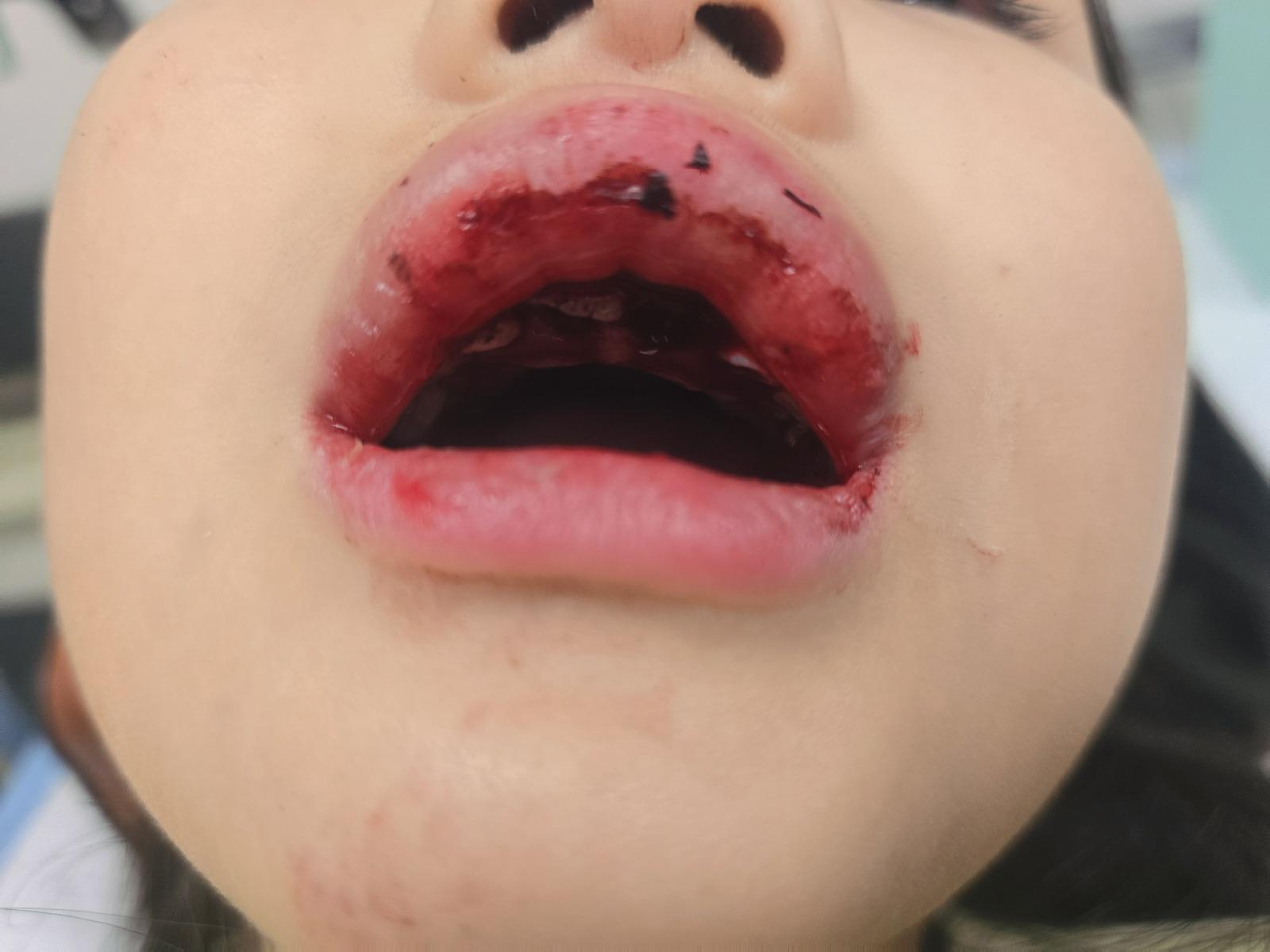 클릭하시면 원본 이미지를 보실 수 있습니다.