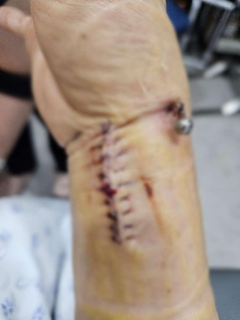 인스타 DM 제보-농아인 어머니, 고대 안암역 폭행상해 피해 후 수사 미흡 제보제보 내용-묻지마 폭행에 관련돼서 더딘 수사 진행에 관해 제보하려 합니다.저희 어머니는 청각장.jpg