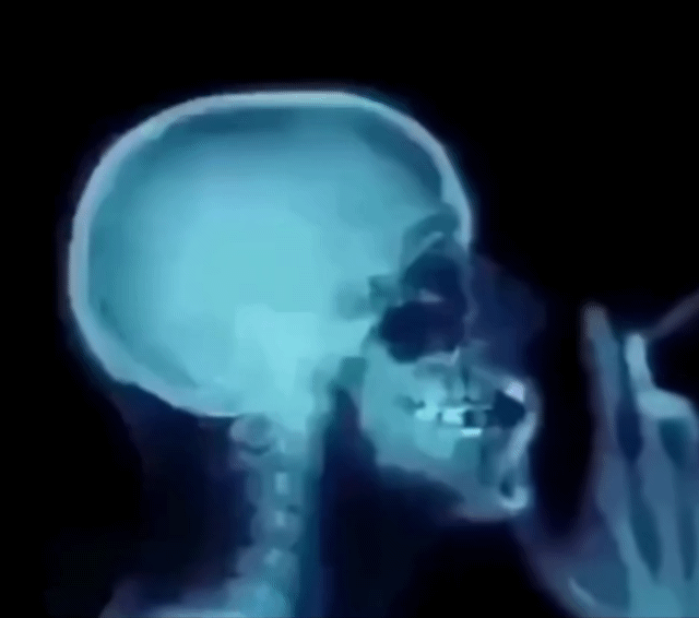 1.gif