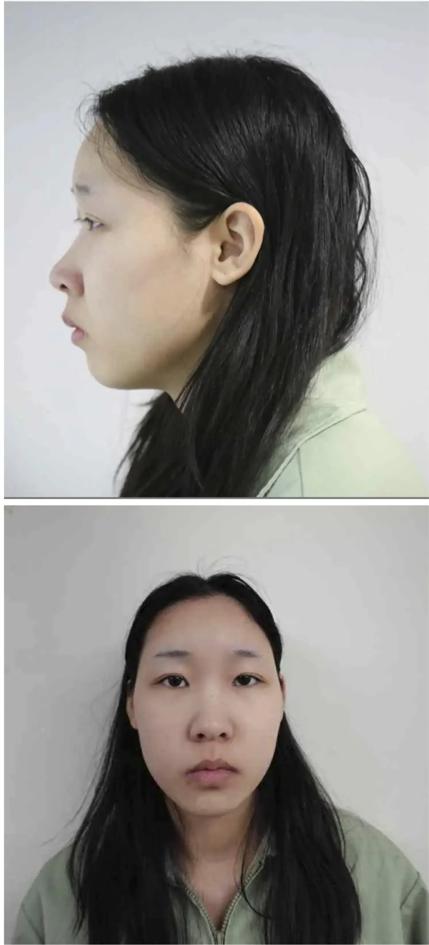 ut36106elz7tmfs68rdi.webp