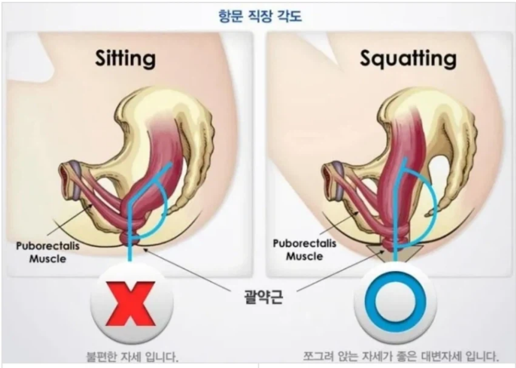 큰거1.png