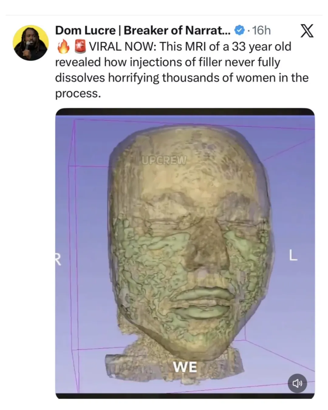 657777467_18056547557705313_1811941879301243405_n.webp