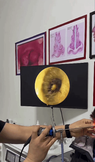 0b9a1cc53223048f7d287edacb848d3f1fb179cd.gif