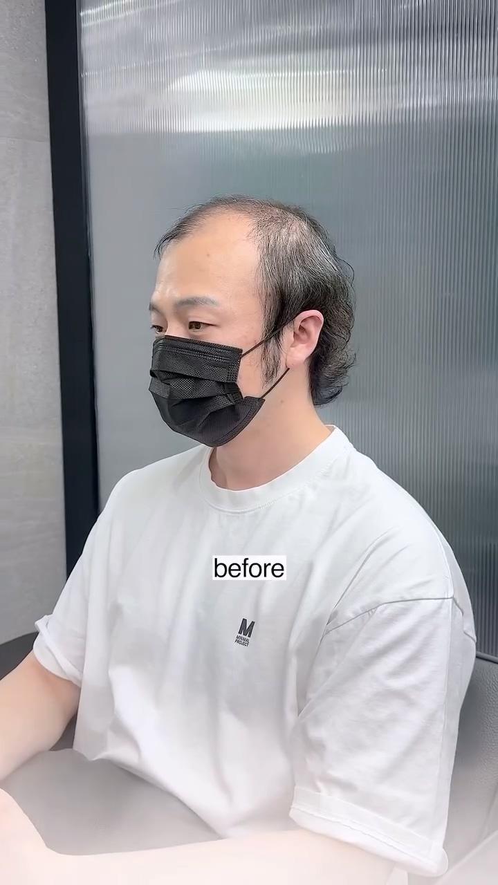 1000025551.mp4_20260518_124213.805.jpg