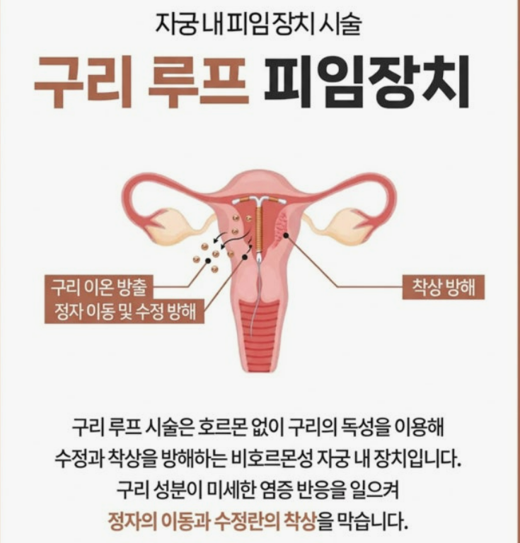 루프피임 .png