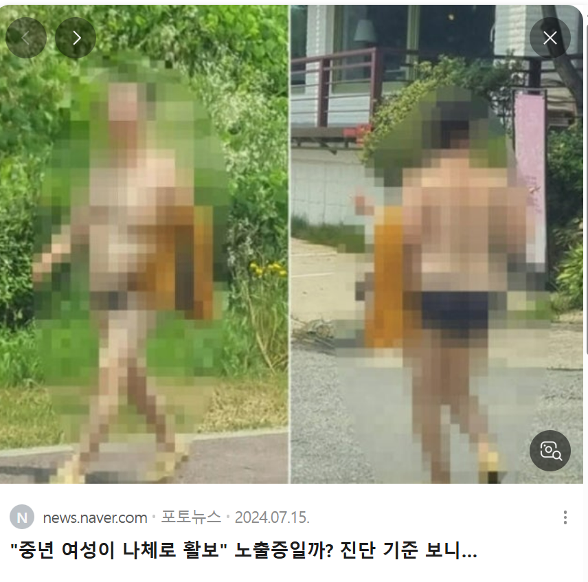 노출 중년여성.png