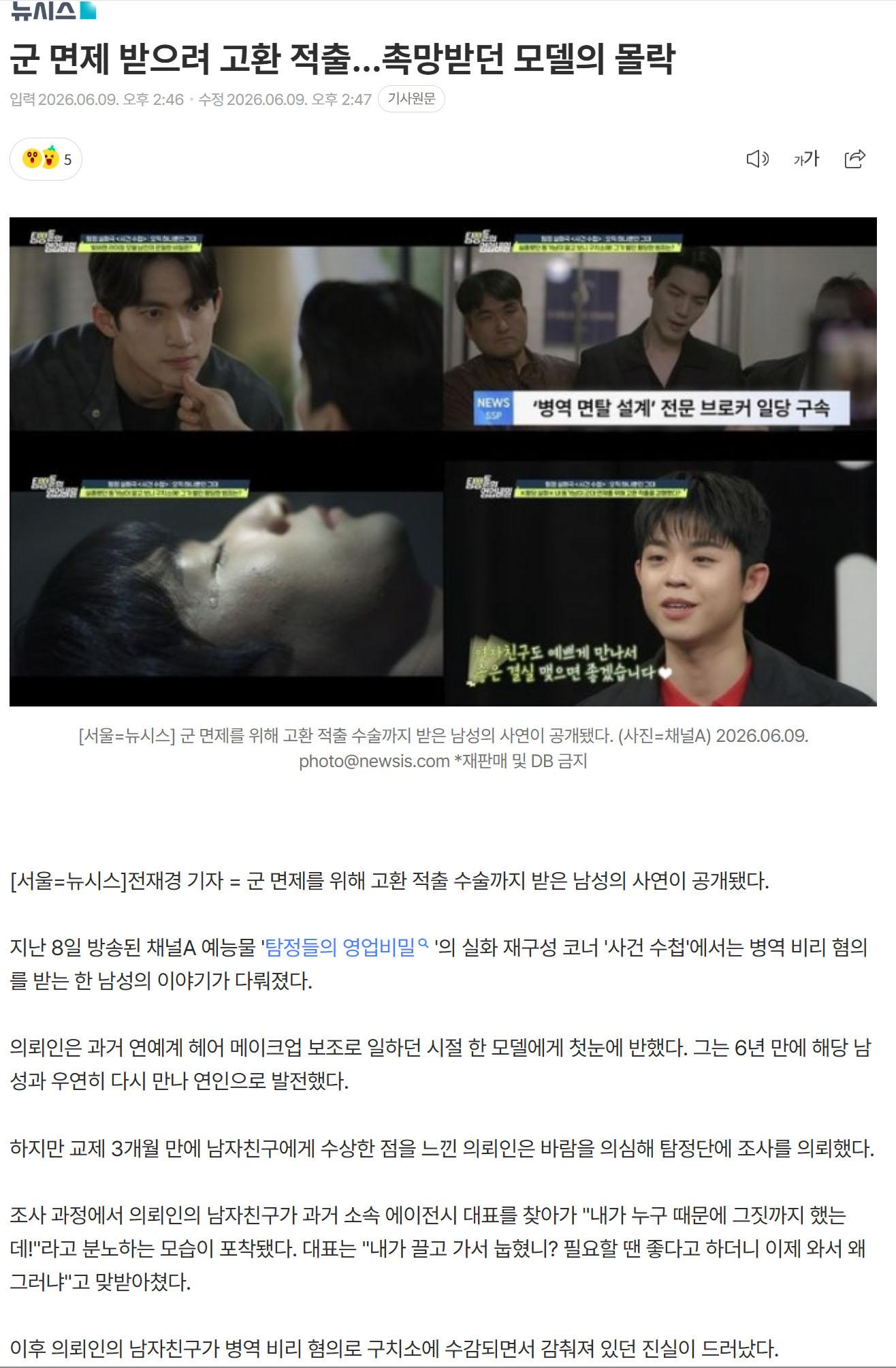 척출.jpg