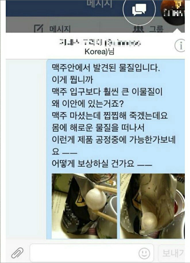 얼마나 보상을 받을수 있을까요?? | 보배드림 자유게시판