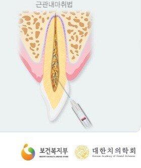 보배치과 이미지