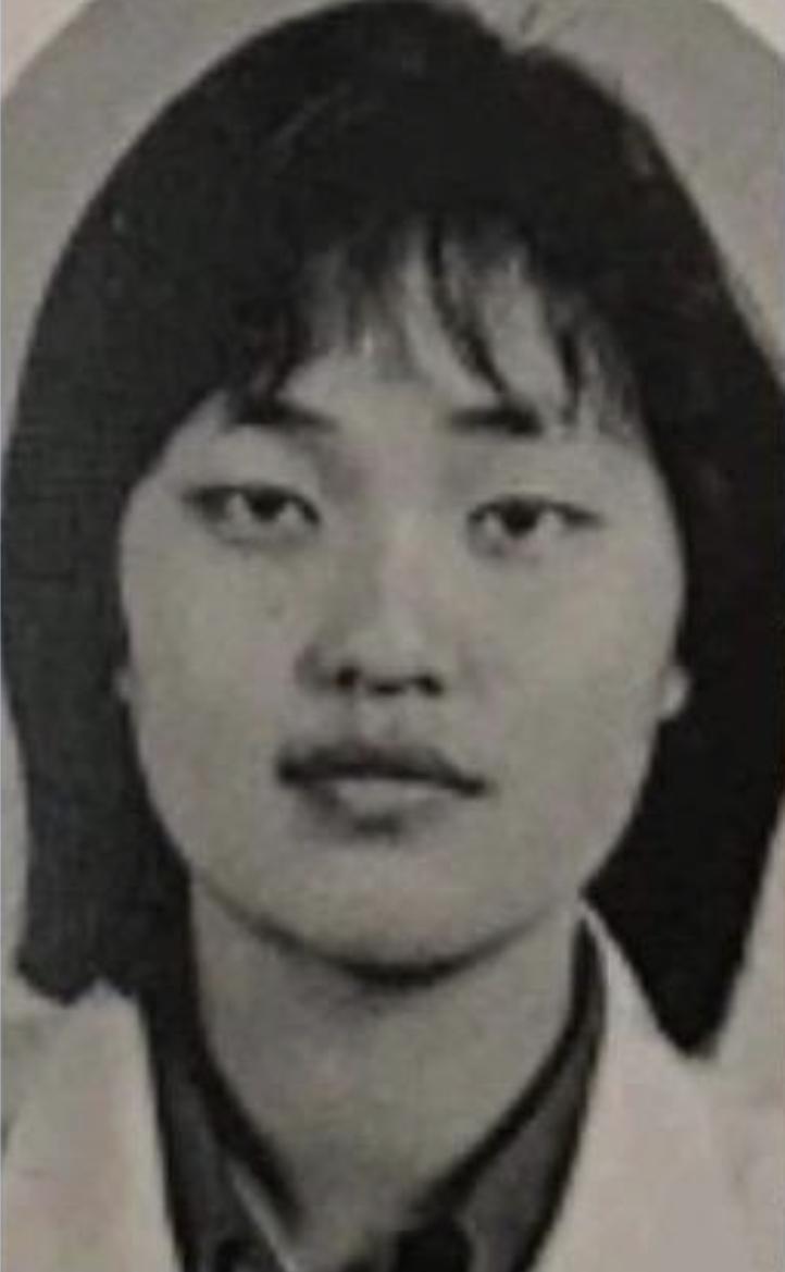 거늬 성형전.jpg