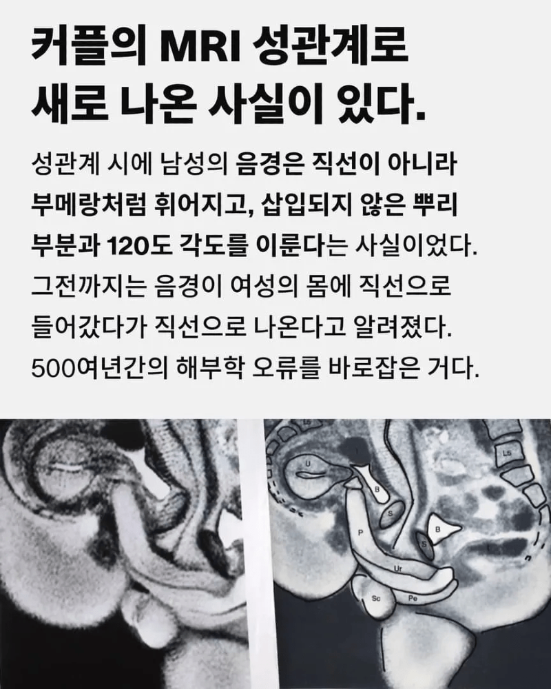 연구를 위해 MRI에서 성관계를 나눈 커플1.png