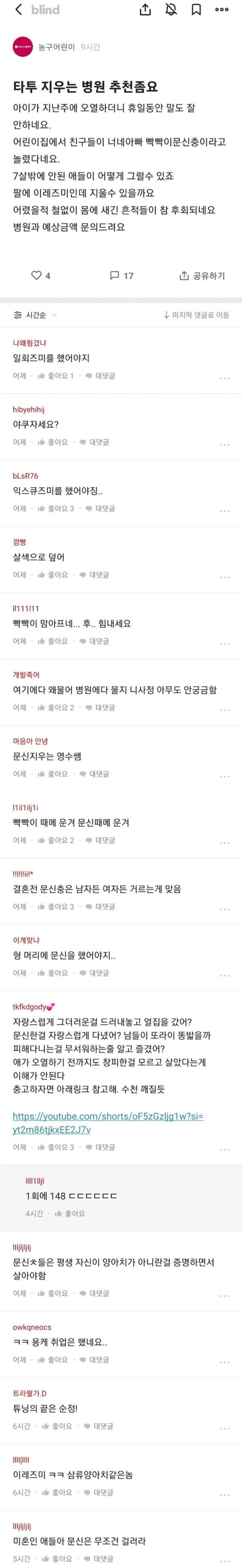 블라인이 문신을 지우려는 이유.JPG