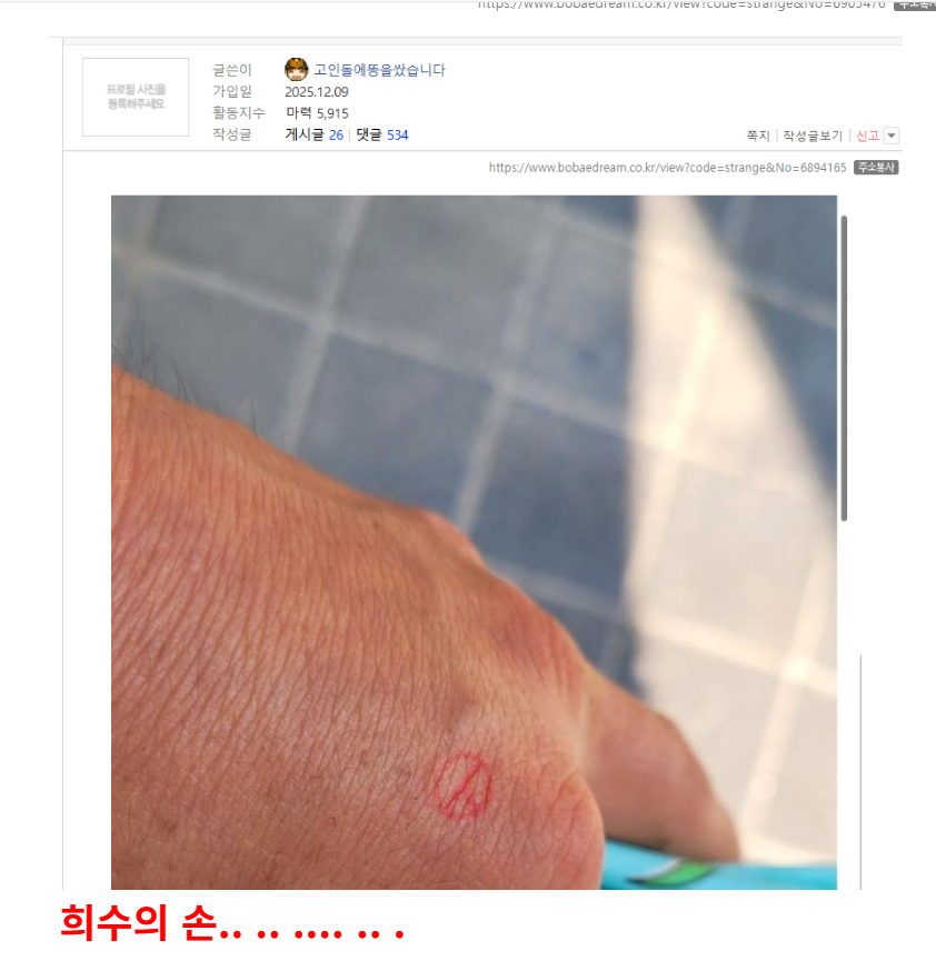 희수의 손.png