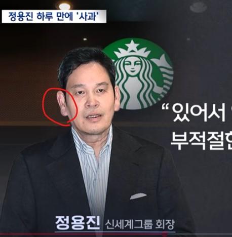 정용진 귓볼수술 후.jpg